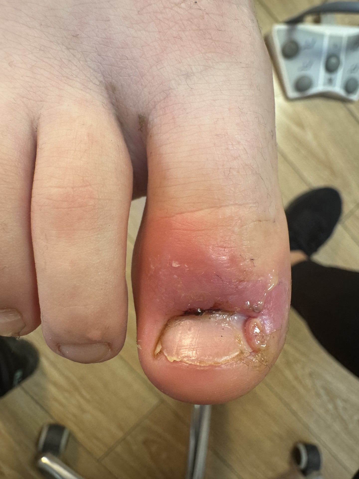 thumbnail_image4